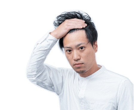 薄毛の悩みを抱える人物