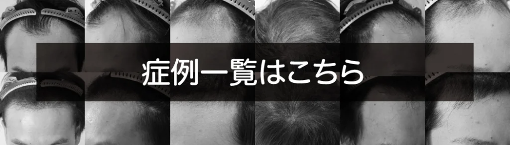 症例一覧はこちら