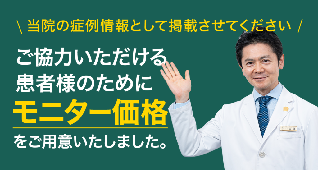 当院の症例情報として掲載にご協力いただける患者様のためにモニター価格をご用意いたしました