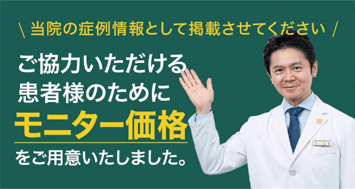 当院の症例情報として掲載にご協力いただける患者様向けのモニター価格案内