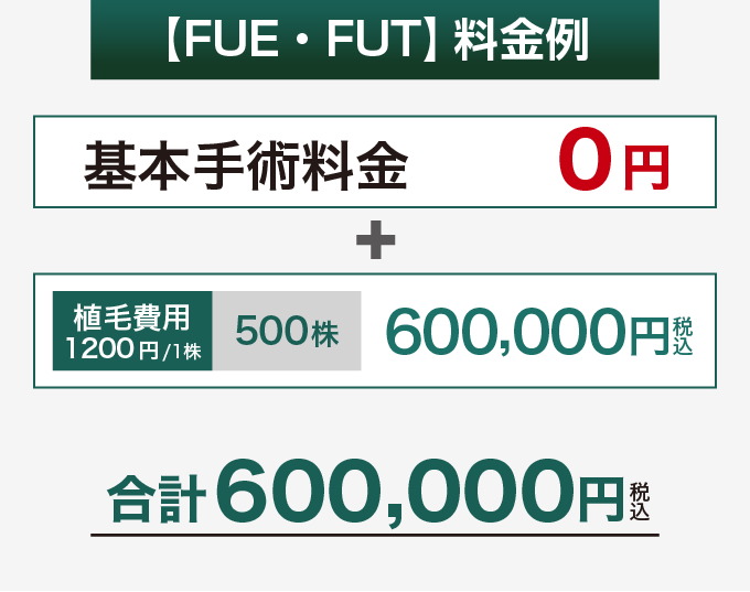 FUE・FUTの料金例、500株の合計600,000円(税込)